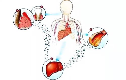 免疫球蛋白g4相关性胆管炎,以为是癌症