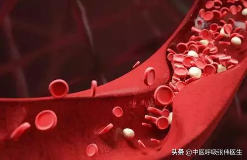 肺动脉血栓抗凝治疗,肺动脉血栓的护理