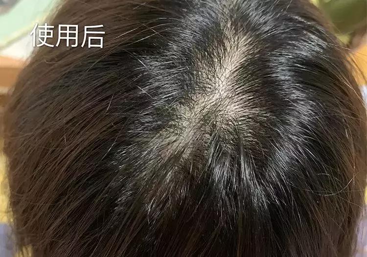 适合清扬的樱花洗发水,明星都在推荐洗发水止痒控油