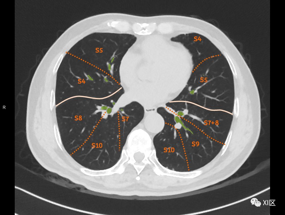 如此详细的肺部影像解剖，有点儿酷！