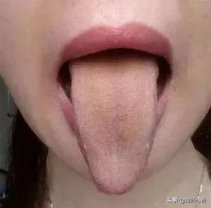 舌头健康表现,舌头出现信号对身体有什么危险