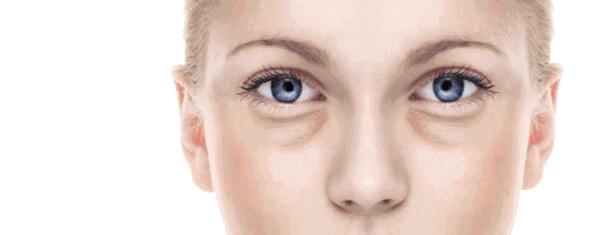 外切祛眼袋和内切祛眼袋哪个好些,超声祛眼袋好还是射频祛眼袋好呢