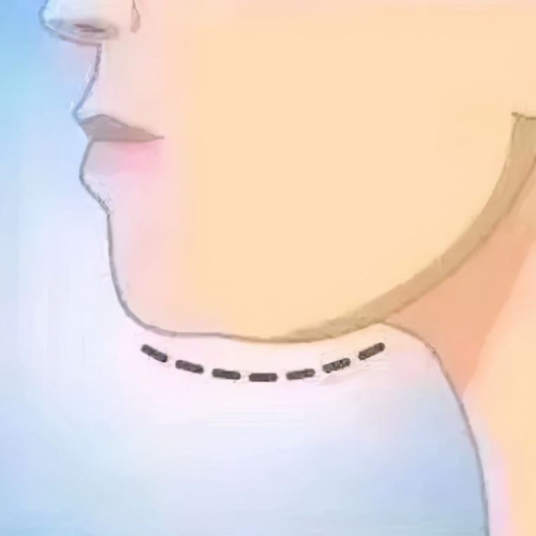 有一种美叫不露胳膊不露腿,因为有双下巴所以从不低头