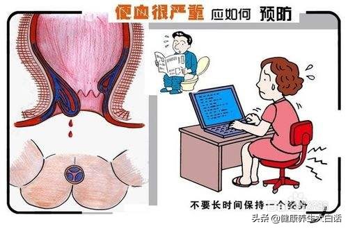 痔疮肿痛怎么办不治疗会发生什么,痔疮最快简单消除的办法