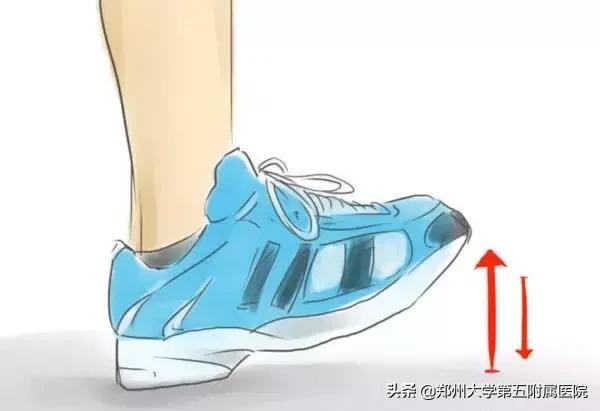 孕期如何预防深静脉血栓,妊娠期静脉血栓的高风险因素