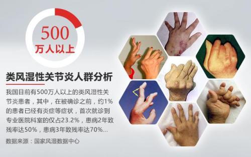 类风湿保养,类风湿病人冬季可以吃冬瓜吗