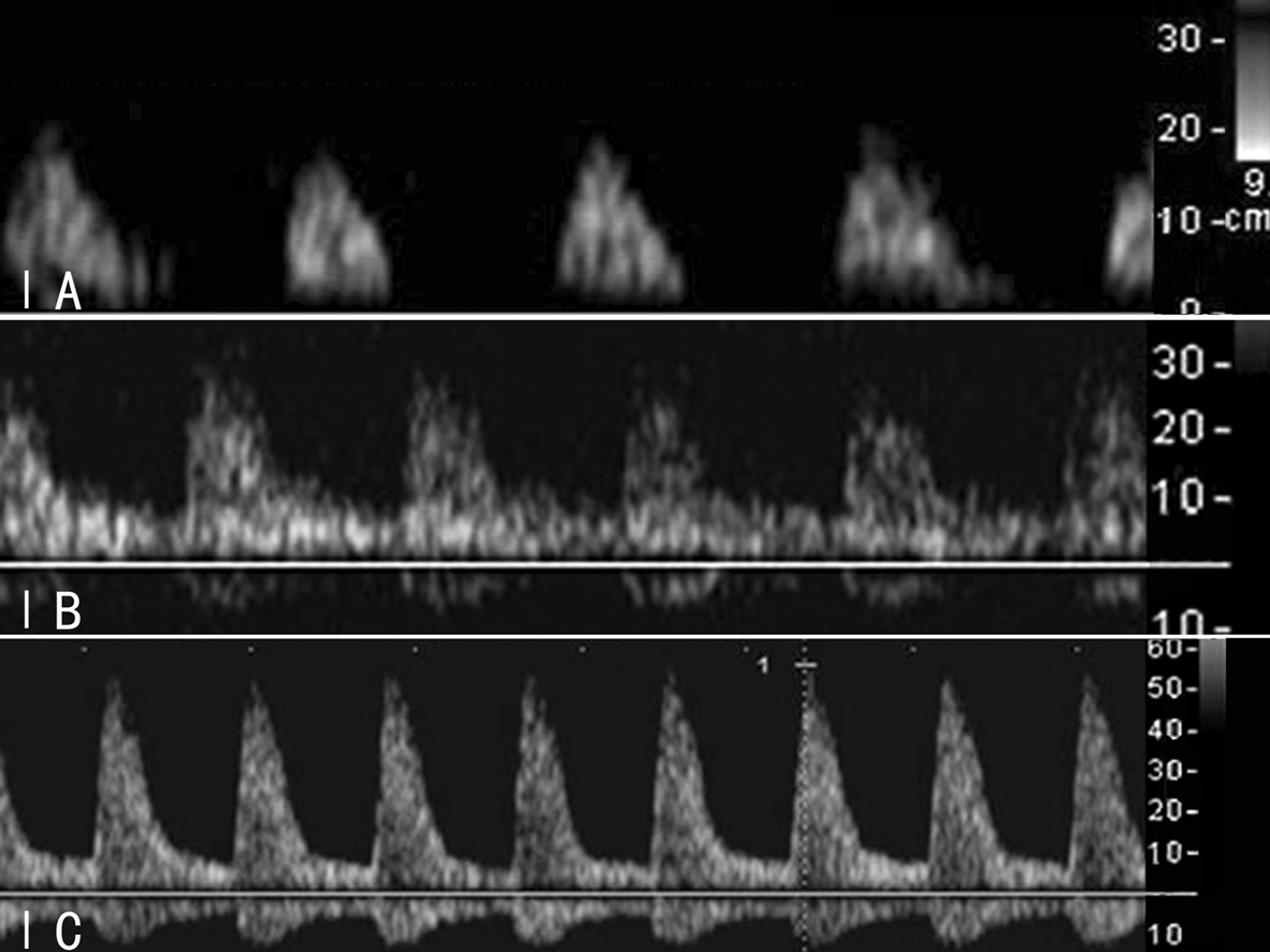 做彩超显示胎儿内脏在右边正常吗,胎儿系统性彩色多普勒超声筛查