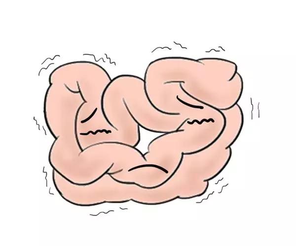 你便秘,你的便秘是怎么来的