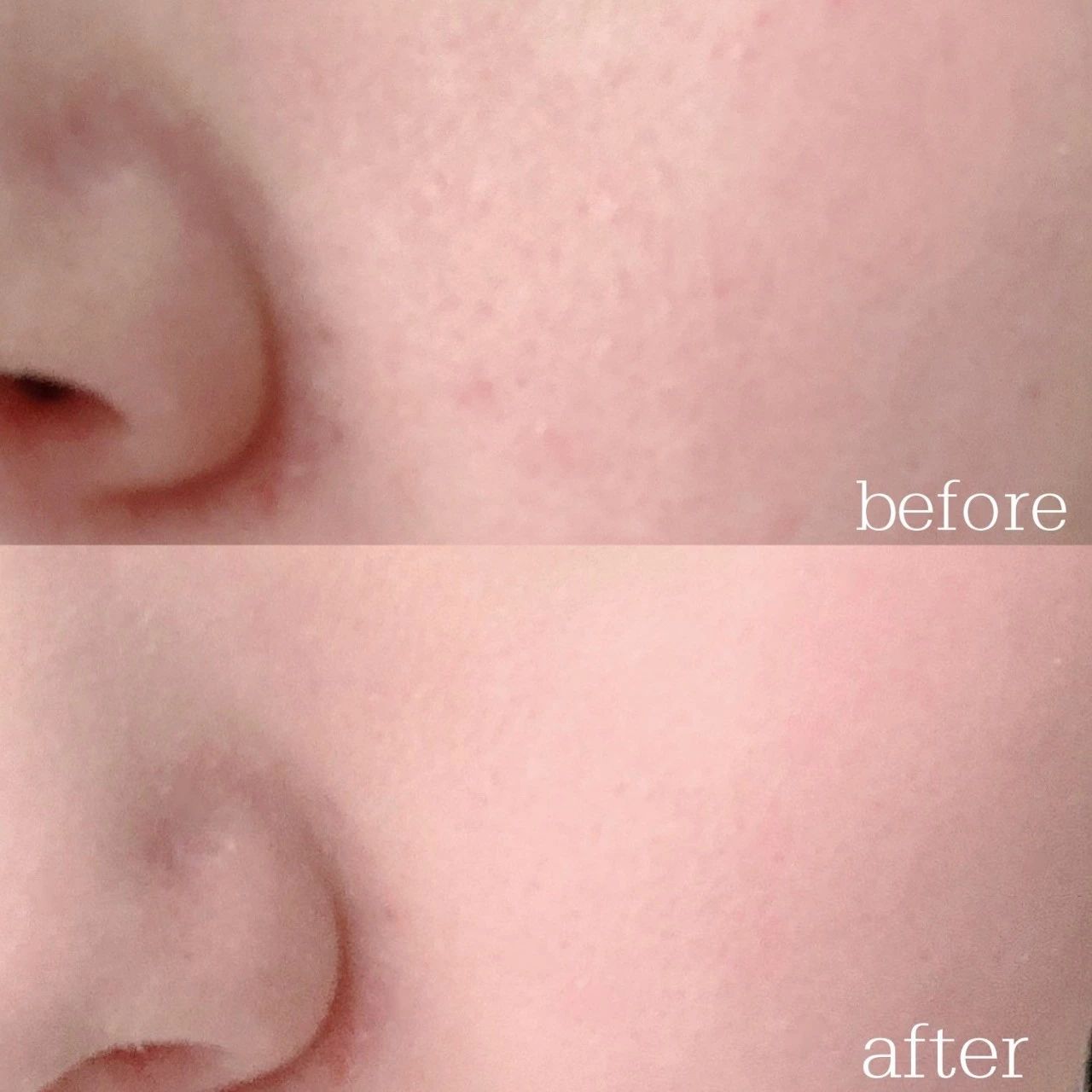 被多人种草的五款大牌气垫,三款好用的气垫有哪些