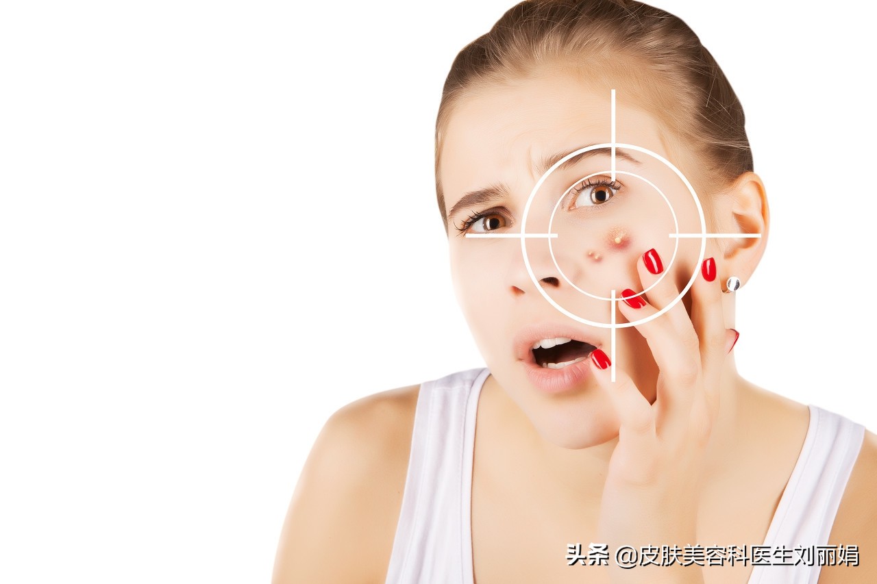 手挤痘痘发炎了怎么办,千万别乱挤痘痘一不小心就进了icu