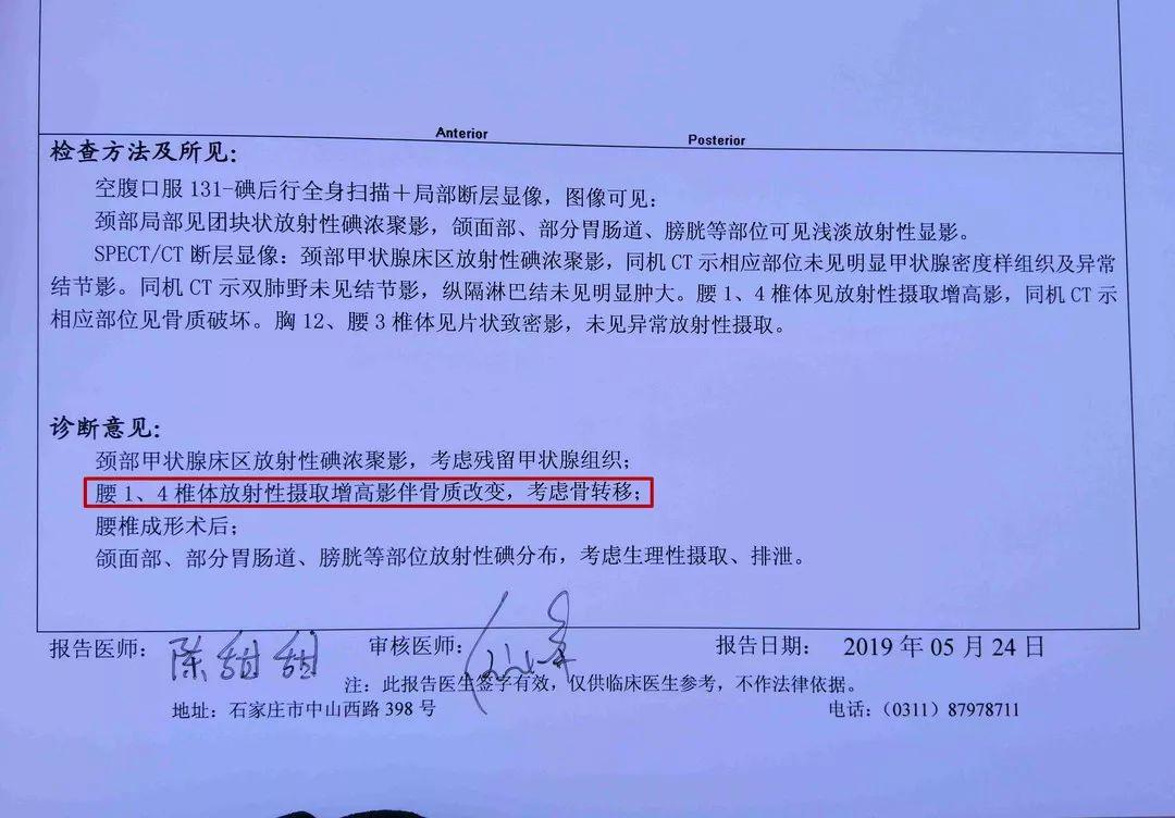甲状腺结节时间长会转变成癌症吗,两个甲状腺病灶算不算严重