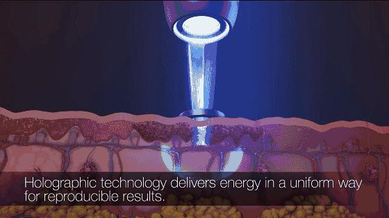 打完玻尿酸和瘦脸针的注意事项,打完玻尿酸和瘦脸针应该注意什么