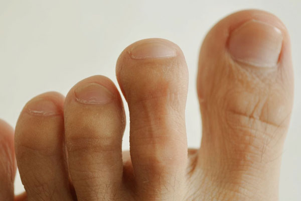 老是脚痒,糖尿病脚痒怎么缓解