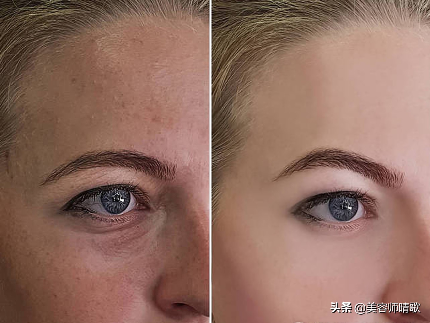 小白瓶淡斑精华推荐,淡斑小白瓶精华