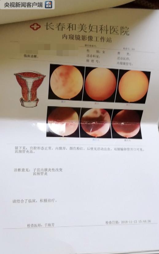 长春和美妇科医院处理的结果,长春和美妇科医院
