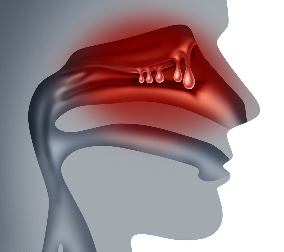 鼻涕由清变黄稠是什么感冒,鼻涕由清变黄又变清说明什么