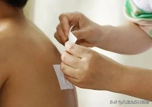 冬病夏治三伏贴的处方,风湿类疾病三伏贴