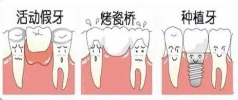 种牙缺颗门牙,种牙缺齿需矫正吗