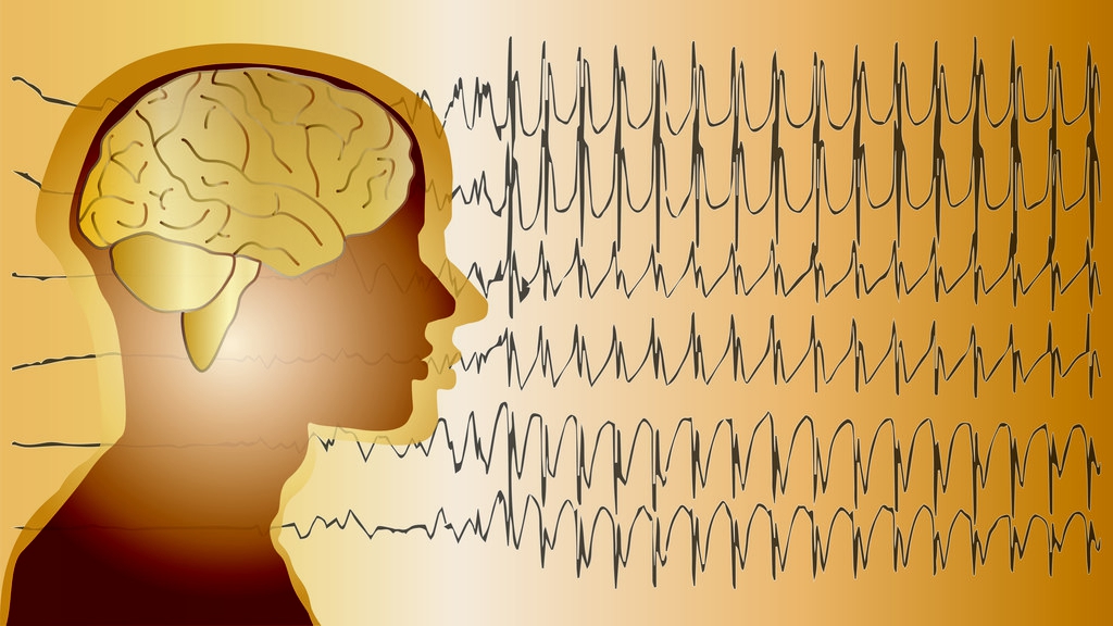 为什么癫痫越治越厉害,小儿癫痫用药多久能控制不发作