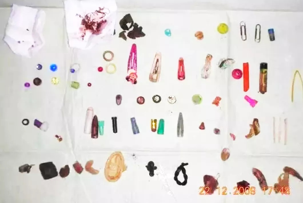 濂崇浣撳唴涓嶆槑鍘熷洜鍑鸿,濂崇浣撳唴鑾悕澶ч噺鍑鸿