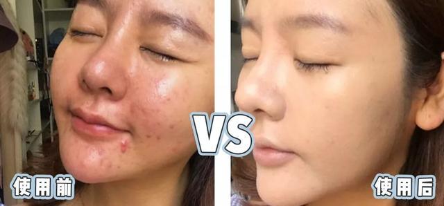 张韶涵新西兰化妆品,张韶涵美妆品推荐