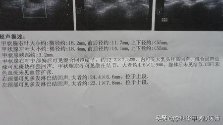 砂粒样钙化是什么意思,钙化结节和肿瘤结节区别