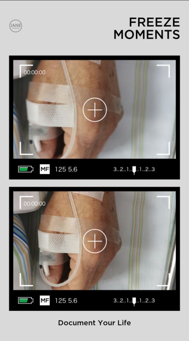 慢性疲劳拔罐手法视频,拔火罐能消除疲劳吗