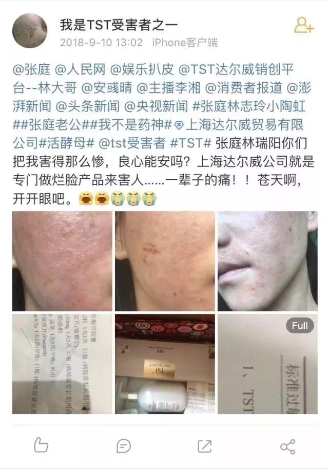张庭为什么会做微商,你瞧不起的明星