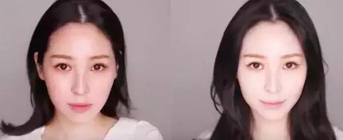 欧阳娜娜擦什么药膏好,欧阳娜娜安利祛疤膏