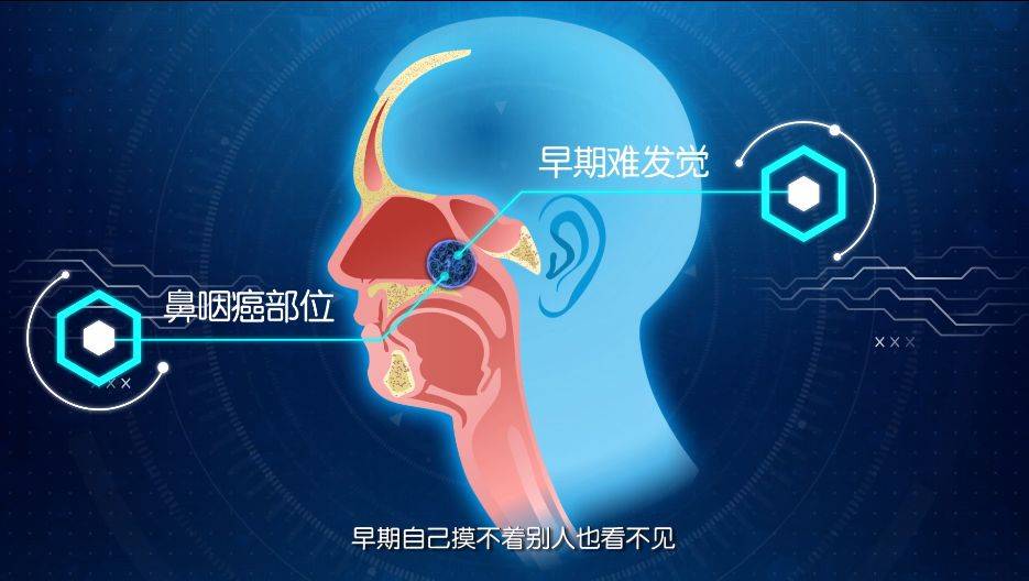 这些症状或许是癌的征兆,双侧咽隐窝稍变浅是鼻咽癌症状吗