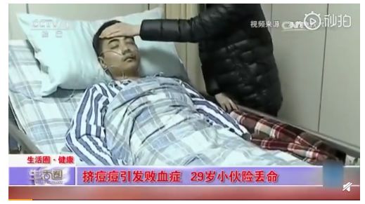 挤痘进了ICU，连下两次病危通知？这痘痘到底还能不能挤！