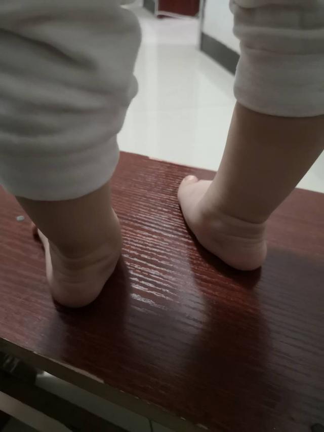 治疗足外翻哪家医院好,什么是足外翻与足内翻