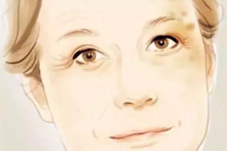 县医院美容科能祛斑吗,医院美容科祛斑全过程