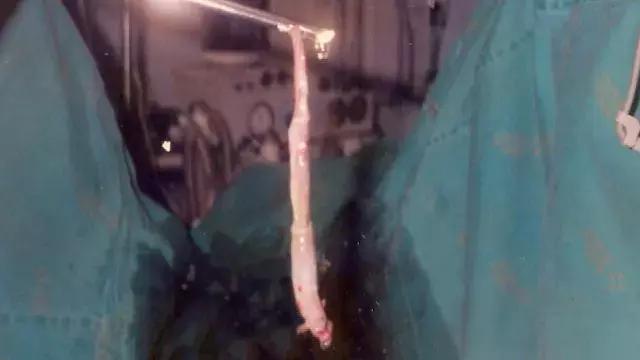 亚马逊河里的恐怖之处,亚马逊河里有多恐怖