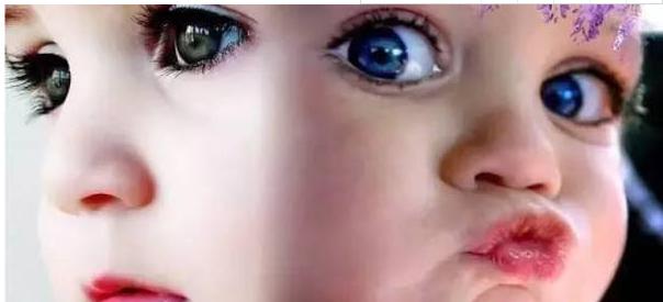 高度近视眼生孩子最好剖宫产吗,孕妇近视不能顺产做近视手术