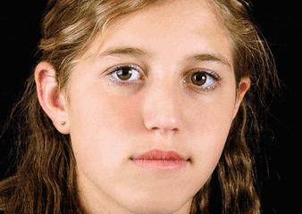 祛色斑的小窍门,色斑严重学会这几招省钱又有效