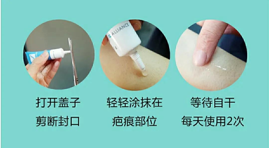 疤痕凝胶和疤痕贴怎么配合用,施可复疤痕凝胶如何正确使用