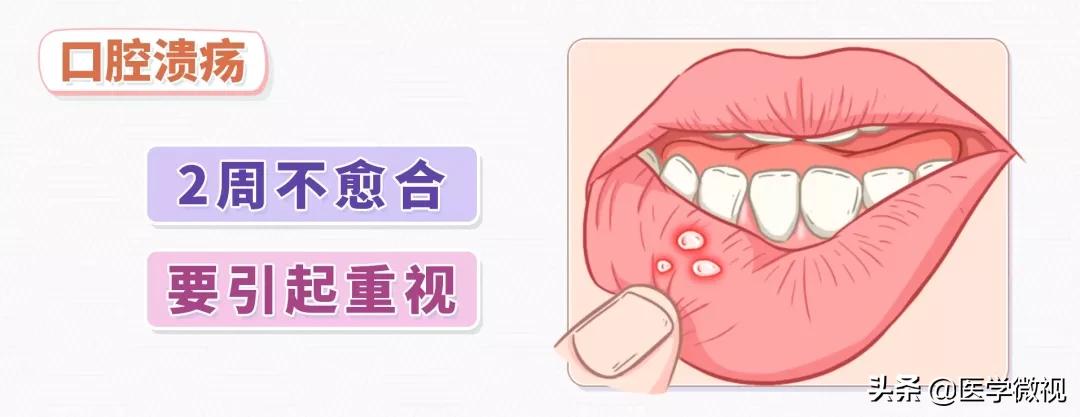 口腔溃疡引起淋巴结一般多久自愈,口腔溃疡的自愈和白细胞有关系吗