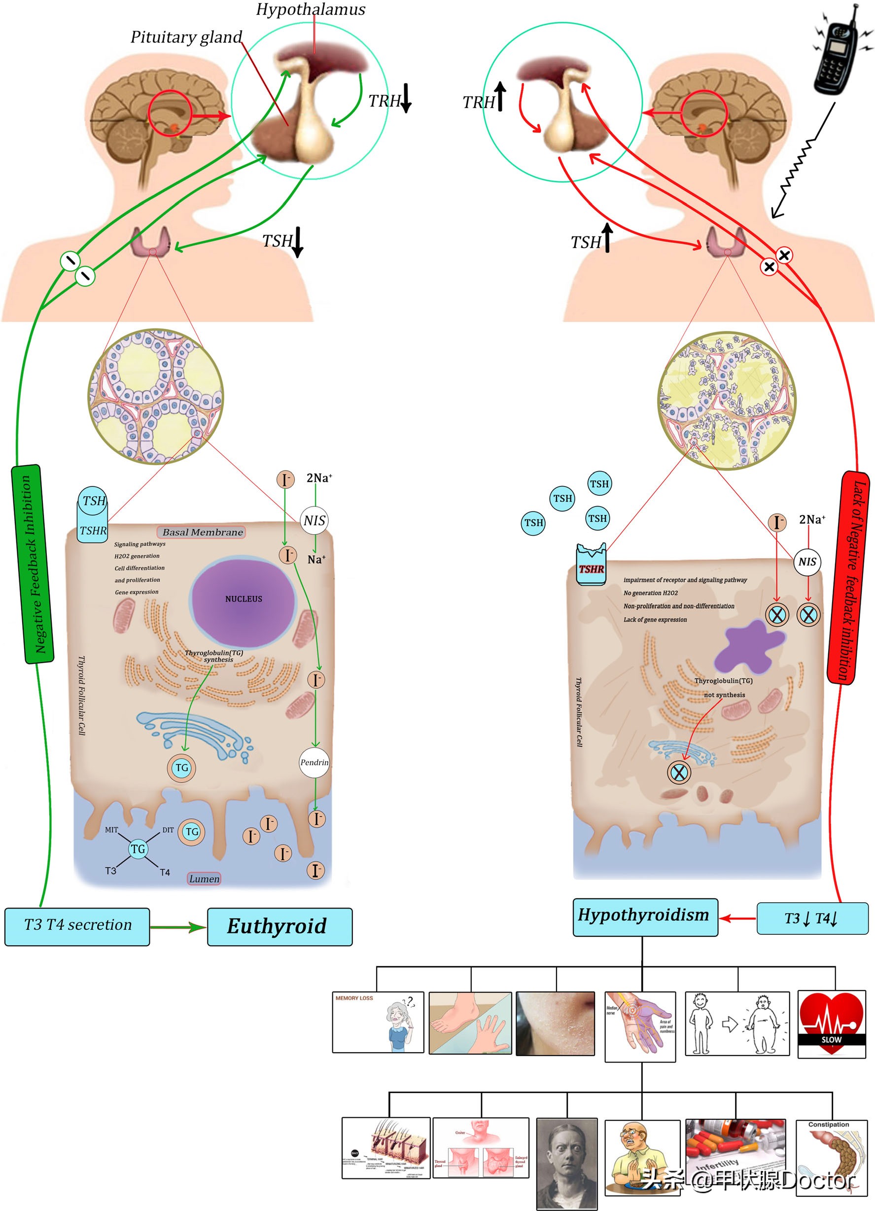 手机辐射大对甲状腺有影响吗,手机辐射对甲状腺有害吗