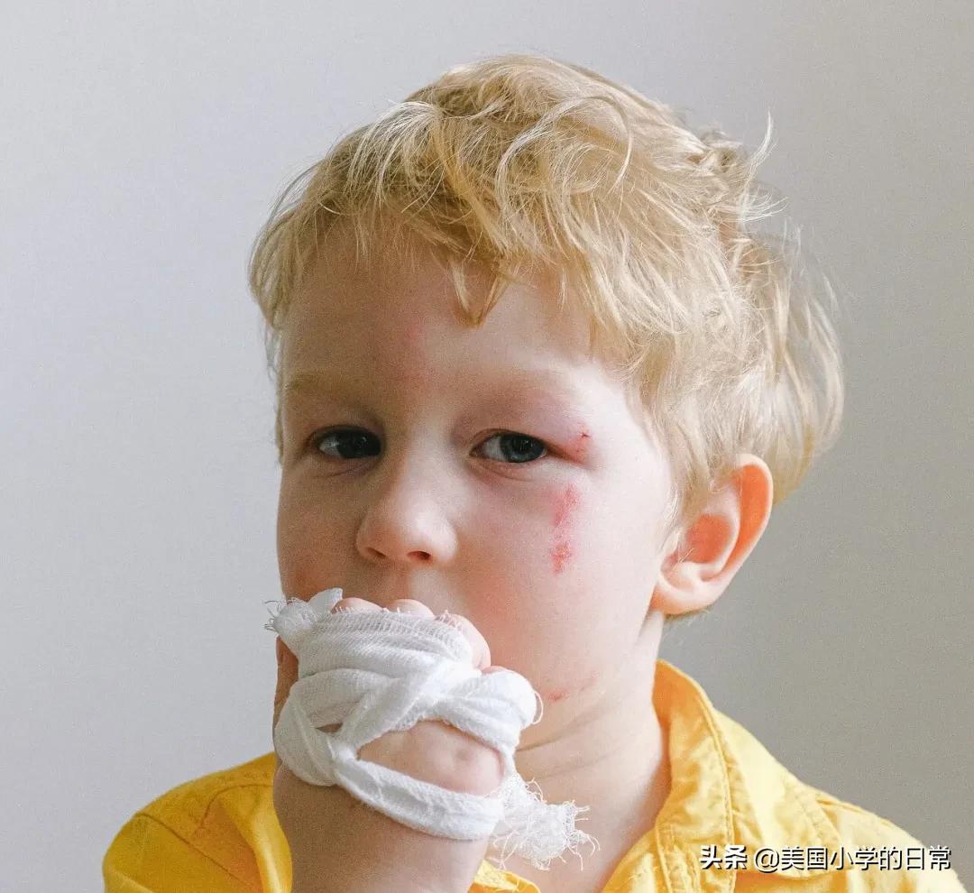 孩子被打该怎么办,孩子被打该怎么办呢