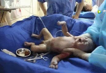 冬天的产房也是冰冷的吗,产房真实现象