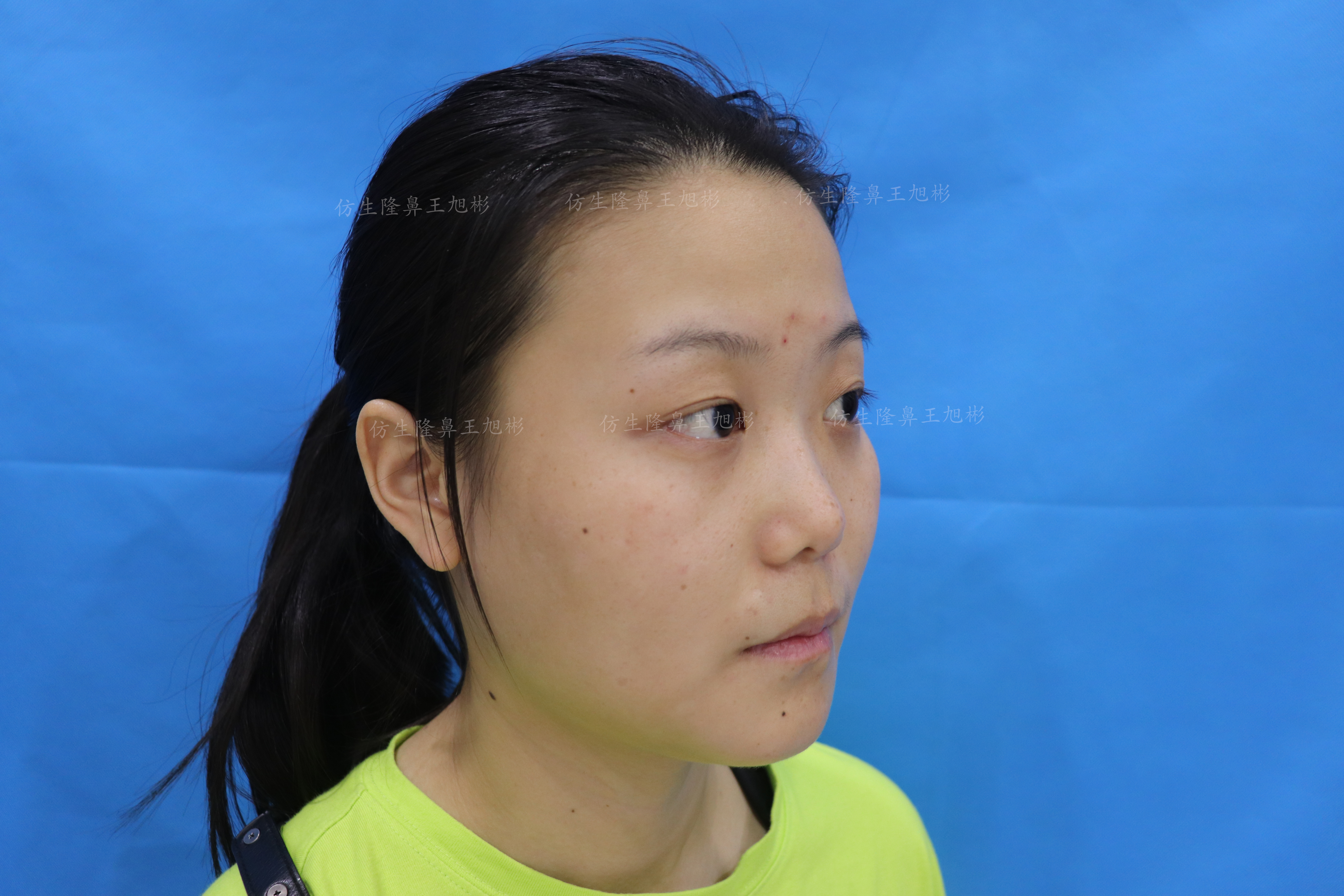 五官扁平的大饼脸,大饼脸和扁平五官怎样自救