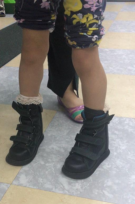 定制矫正鞋鞋垫,定做矫正鞋的地方在哪里