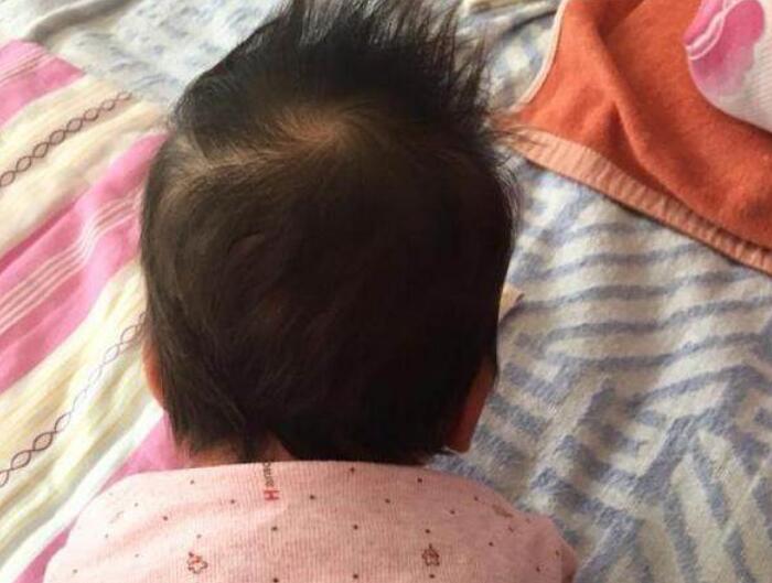 宝宝睡偏头了该如何纠正,如何防止宝宝睡偏头及补救方法