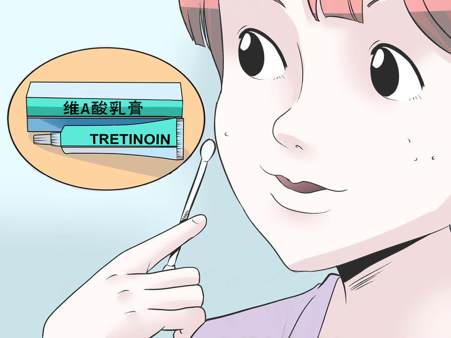 外用酸类的药物,外用酸类药品有哪些