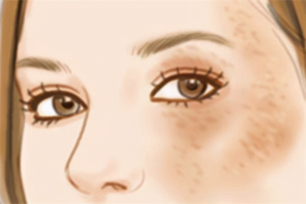 脸上的斑一直去不掉是怎么回事,脸上的色斑一直不消怎么办