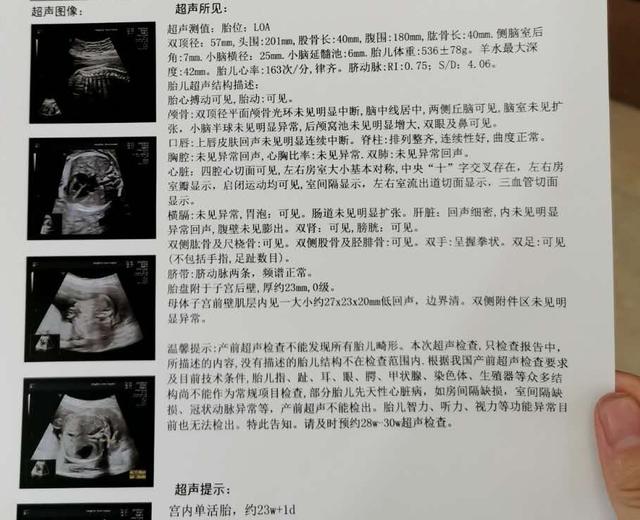 孕早期会不会引起甲亢或者甲减,记录十个月孕期