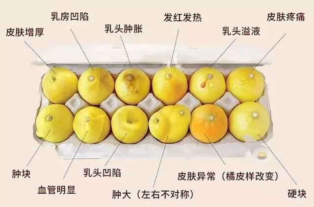 哺乳的女人为什么不容易患乳腺癌,哺乳期乳腺癌的征兆有哪些呢