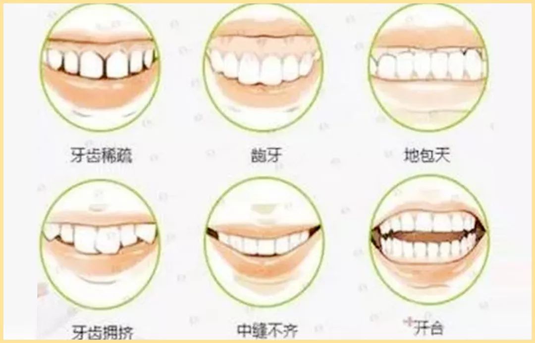 孩子已经三岁断奶的正确方法,孩子多大断奶好很多妈妈都搞错了
