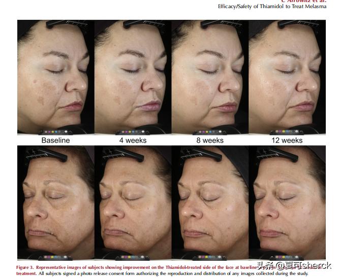 妮维雅630夏季美白,夏可叔叔扒产品